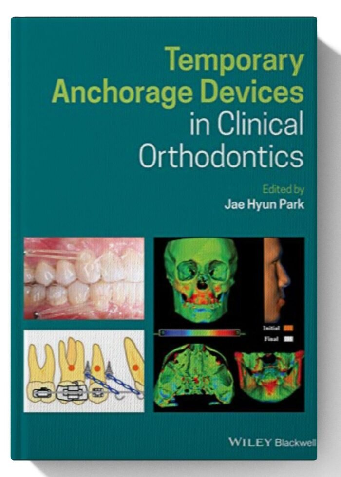 Temporary Anchorage Devices in Clinical Orthodontics 1st Edition