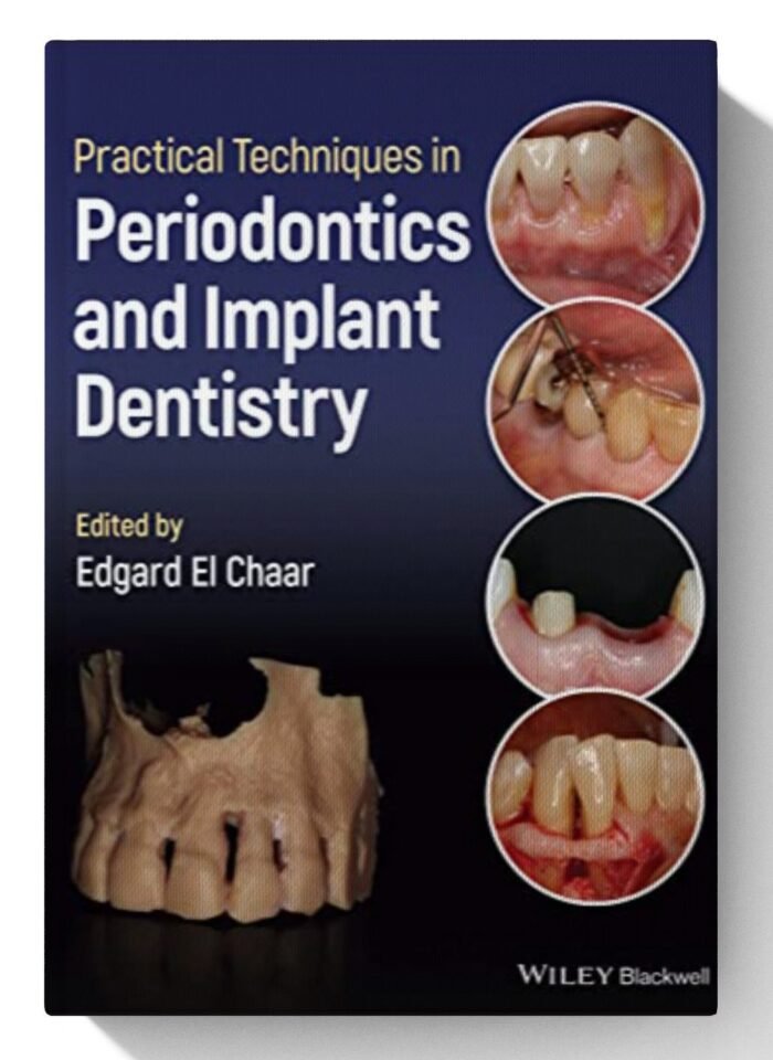 Practical Techniques in Periodontics and Implant Dentistry 1st Edition