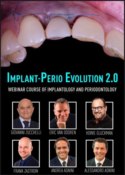 Implant-Perio Evolution 2.0